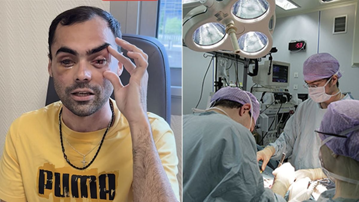 Un aveugle retrouve la vue en se faisant greffer… une dent dans l'oeil